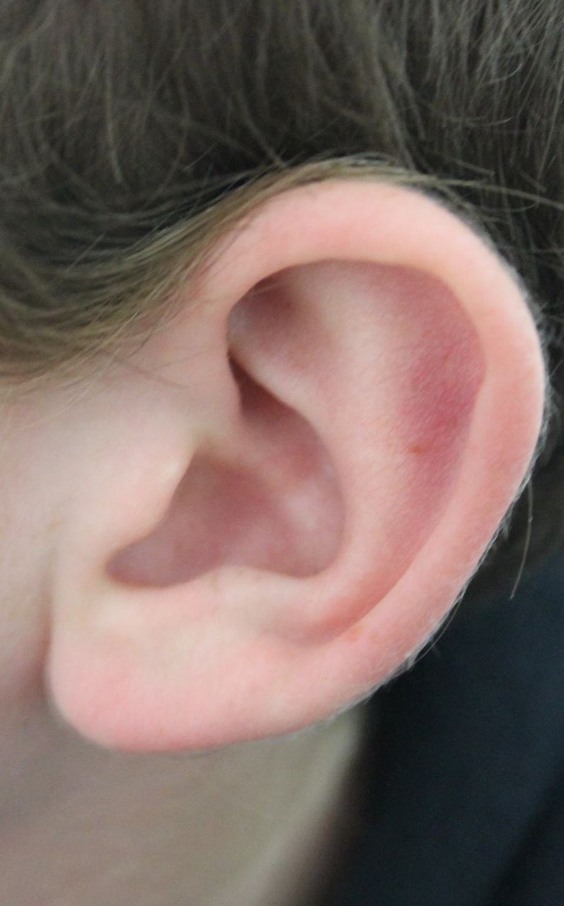 EAR